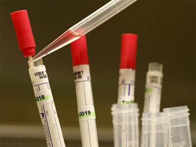 基因检测：梦想饱满 现实骨感